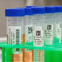 Più campioni etichettati con codici QR.